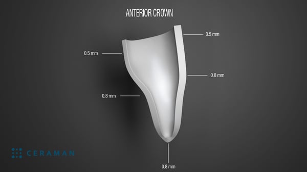 Anterior crown