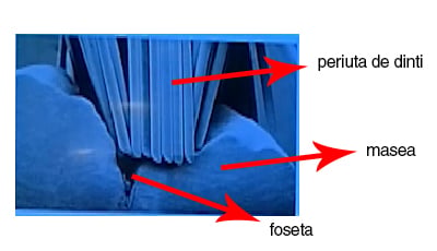 foseta