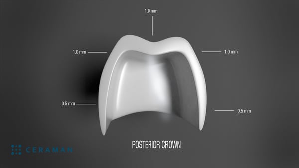 Posterior crown