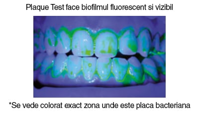 plaque-test-zona-bacteriana-1